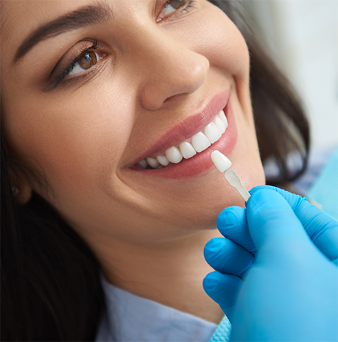 Woman having teeth shade matched