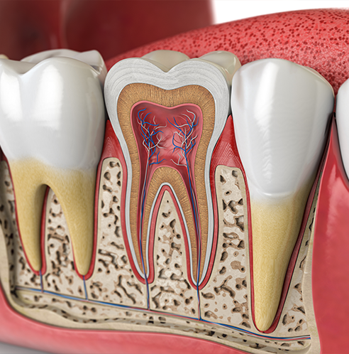 Illustration of inside of tooth in jaw