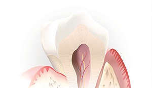 Animation of inside of tooth