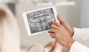 Digital dental x-rays on tablet computer