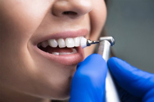 Close up of dentist examining a patient’s teeth