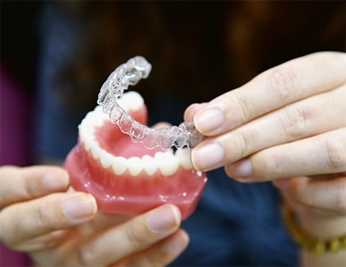 Placing clear aligner on top of model of teeth