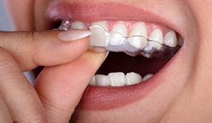 a person wearing ClearCorrect aligners in Midland