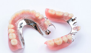 two partial dentures with metal clasps
