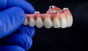 gloved hand holding an implant denture