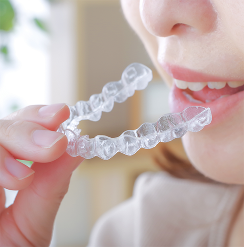 Woman about to put in a nightguard for bruxism