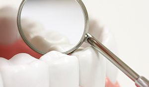 Closeup of teeth with sealants