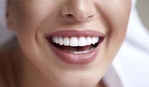 Closeup of woman smiling with veneers in Midland