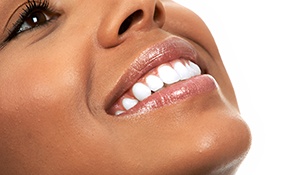 woman smiling with white teeth angled upward