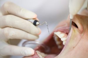 periodontal exam
