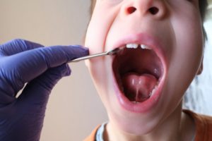 young patient who has reasons for children’s tooth extractions